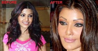 Koena Mitra before and after Surgery