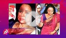 BREAKING: Hema Malini INJURED In An Accident | Bollywood News